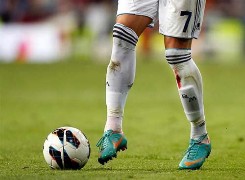 Kinh hãi Ronaldo rách chân, đổ máu - 5