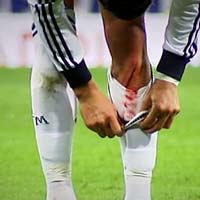 Bóng đá - Kinh hãi Ronaldo rách chân, đổ máu