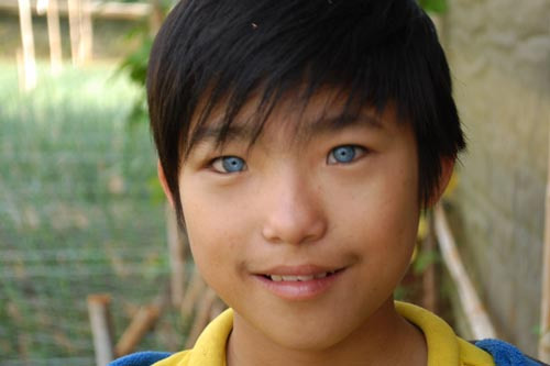 Đà Lạt: Cậu bé mắt xanh biếc là do di truyền? - 1