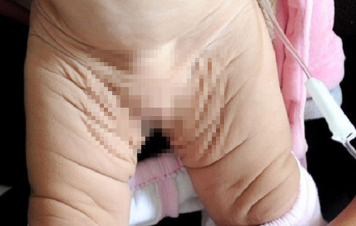 TQ: Xót xa bé 1 tuổi già như... bà lão 80 - 3