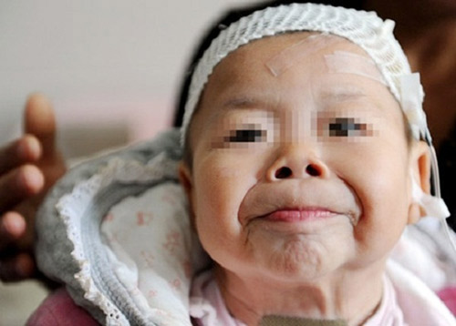 TQ: Xót xa bé 1 tuổi già như... bà lão 80 - 4