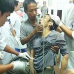 Răng giả nằm trong đường thở... 6 năm