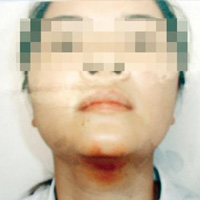 Pháp luật - Cô giáo bị bạo hành cầu cứu