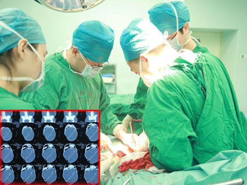 Mang khối u 20 kg tưởng... mang thai - 2