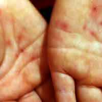 Tin tức trong ngày - Cô giáo mầm non bị “tố” dùng vật nhọn đâm HS