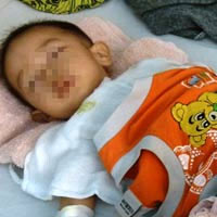 Tin tức trong ngày - Bác sĩ “lỡ tay”, bệnh nhân lãnh đủ