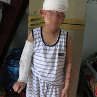 Pháp luật - Thêm 1 vụ chồng tạt axit vợ vì mâu thuẫn