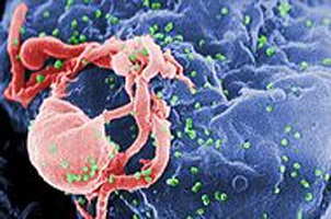 Cảm biến phát hiện virus HIV bằng mắt thường - 1