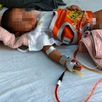 Sức khỏe đời sống - Vụ cắt nhầm bàng quang: Có thể phải tạo lại