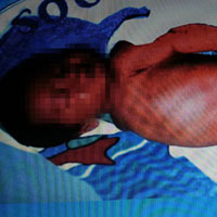 Sức khỏe đời sống - Phẫu thuật chuyển giới theo "giới tính giả"