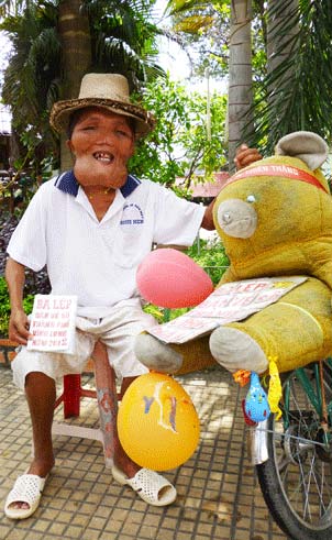 Chàng trai dị dạng vượt lên số phận - 2