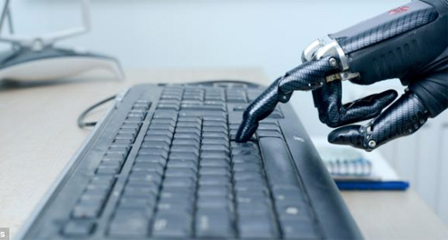 Người đàn ông có cánh tay "kẻ hủy diệt" - 4