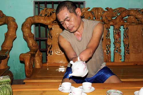 Sức sống của một “kỳ nhân” không tay - 4