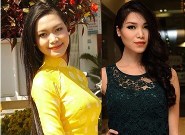 Bật mí giá nâng mũi, gọt cằm của sao Việt - 2
