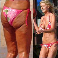 Bí quyết mặc đẹp - Những cặp giò "đáng thương" ở Hollywood