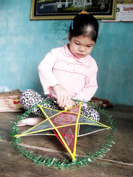 Đau xót cô gái 22 tuổi như bé lên 5 - 1