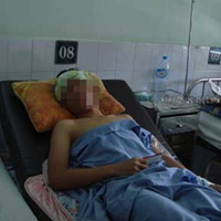 Sức khỏe đời sống - BN bị chuột cắn: Tiêm ngừa uốn ván rồi vẫn bị sốt?