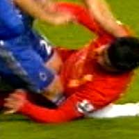 Bóng đá - Cận cảnh Suarez đè gẫy chân Terry