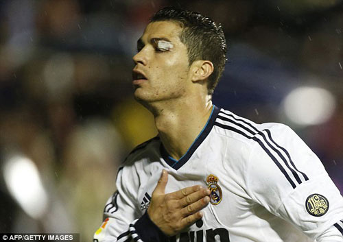 Thị lực giảm, Ronaldo nghỉ thi đấu - 1