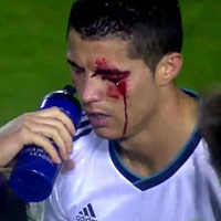 Bóng đá - Thị lực giảm, Ronaldo nghỉ thi đấu