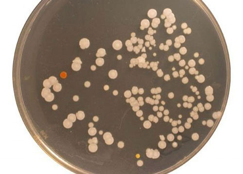 Phát hiện “rừng” vi khuẩn trong rốn người - 2