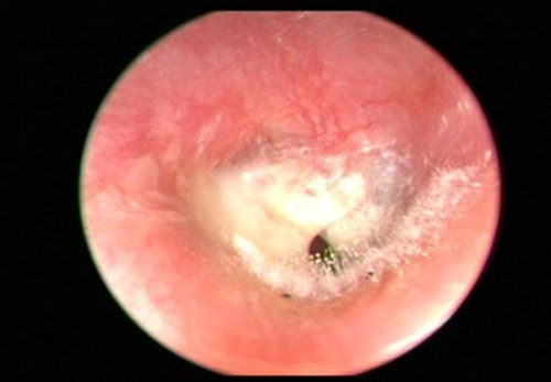Dính bệnh vì thú vui từ tiệm hớt tóc - 2
