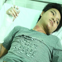 Pháp luật - Bị CA đánh gãy tay vì không đội mũ BH?