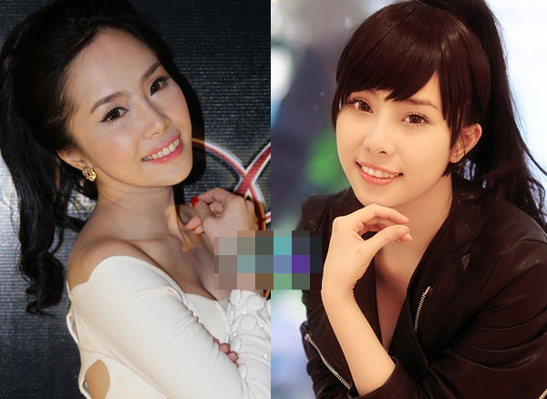 Khuôn mặt Quỳnh Nga sưng phồng khó hiểu - 3