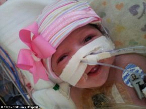 Mỹ: Cô bé chào đời với tim ngoài cơ thể - 1