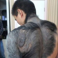 Phi thường - kỳ quặc - Người đàn ông lông lá như tinh tinh