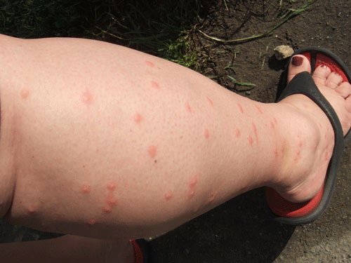 Virus từ chuột gây suy thận hoành hành - 2