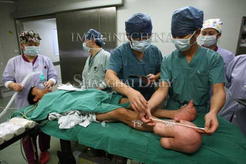 Cậu bé chân to gấp 10 lần bình thường - 6