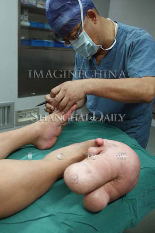 Cậu bé chân to gấp 10 lần bình thường - 7