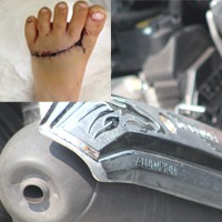 Tin tức trong ngày - "Máy chém" trên xe gắn máy