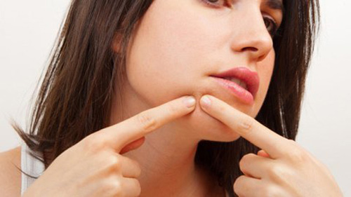 Smartphone phát hiện mụn trước khi “mọc” - 1