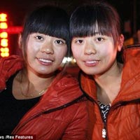 Phi thường - kỳ quặc - Cặp song sinh thất lạc giống nhau kỳ lạ