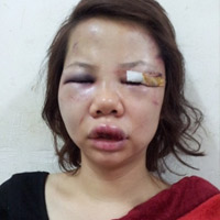 Pháp luật - Suýt mất mạng chỉ vì ‘‘xấu chàng hổ ai”