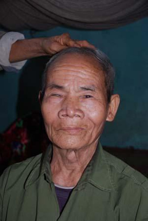 Kỳ bí bệnh mở khóa đầu - 2