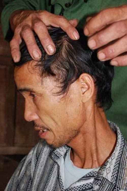 Kỳ bí bệnh mở khóa đầu - 3