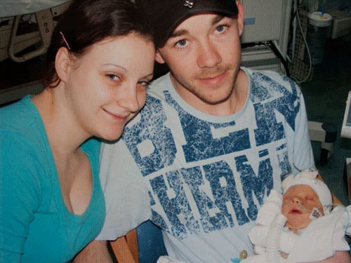 Thương tâm cậu bé mang van tim lợn - 2