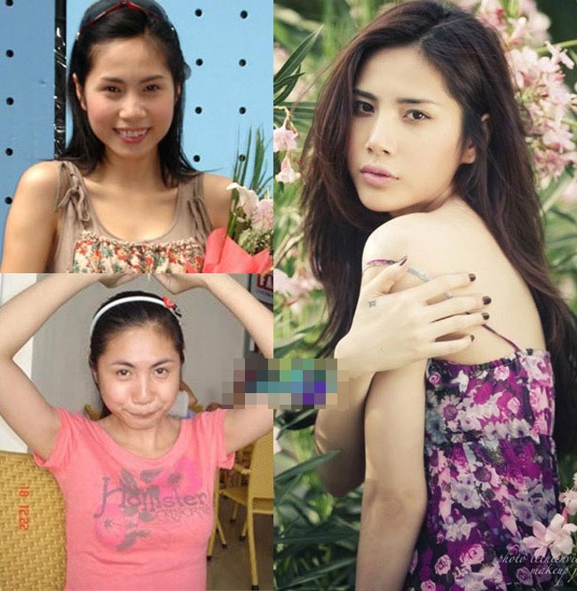 Những cánh mũi đáng ao ước của sao Việt - 5