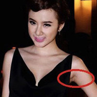 Thẩm mỹ viện - Soi vết tích dao kéo vòng 1 của mỹ nhân