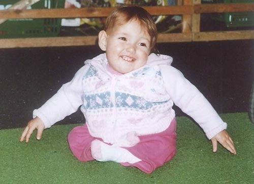 Phẫu thuật thành công ca ghép xương sống bằng xương chân - 2