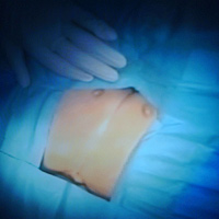 Sức khỏe đời sống - Diễn biến ca tách hai trẻ dính liền