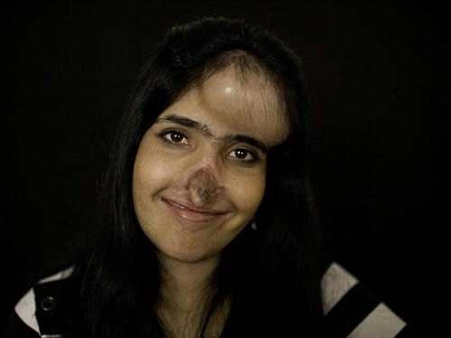 Tin tức trong ngày - Cô gái bị xẻo mũi dũng cảm đối diện sự thật