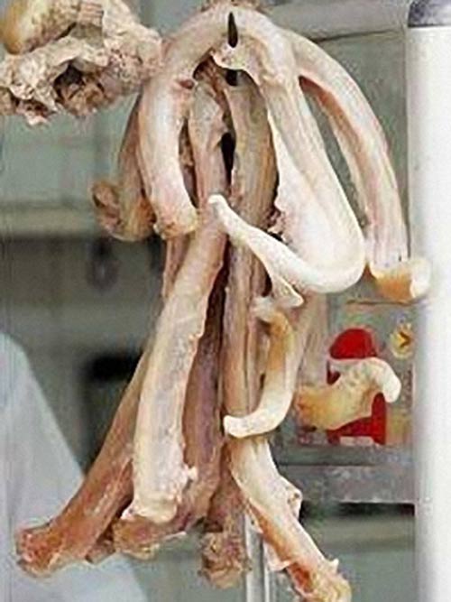 Bi hài chuyện quý ông săn pín chữa...bệnh - 2