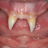 Sức khỏe đời sống - Cậu bé mang hàm răng "ma cà rồng"