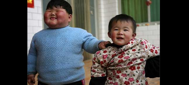 Câu chuyện về cân nặng bất bình thường của bé gái này đã được phát sóng trên kênh KBS của Hàn Quốc vào tháng 6.