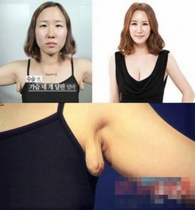 Sốc vì mặt "lưỡi cày" thành đại mỹ nhân - 3