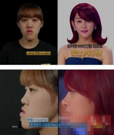 Sốc vì mặt "lưỡi cày" thành đại mỹ nhân - 5